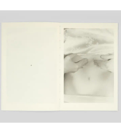 Katya Lesiv: I am going home to eat mulberries from the tree