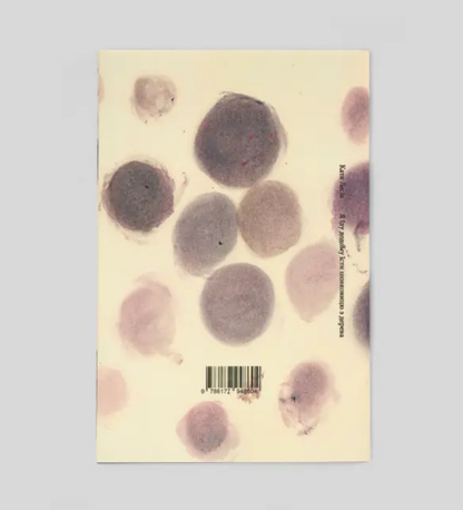 Katya Lesiv: I am going home to eat mulberries from the tree